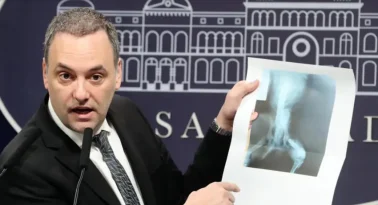 las dos radiografías de Manuel Adorni