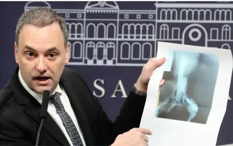 las dos radiografías de Manuel Adorni